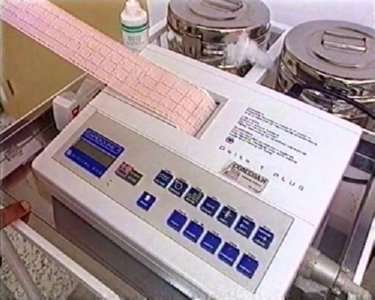 ELECTROCARDIOGRAMA 02  IMAGENES FOTOS